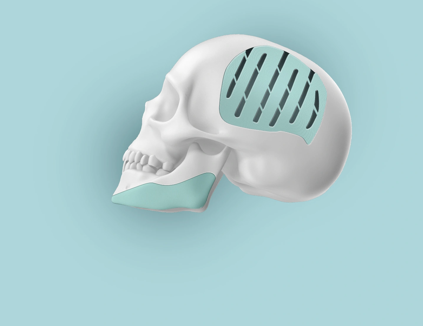 hero image presenting skull implant